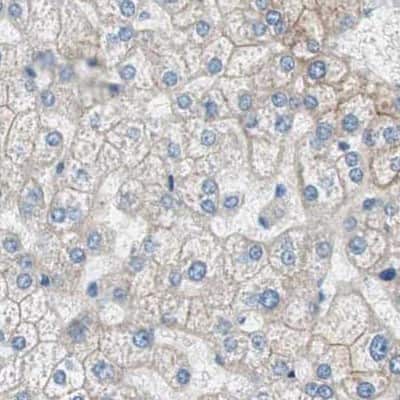 Immunohistochemistry-Paraffin: Villin 1 Antibody [NBP1-85336]