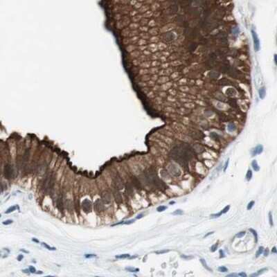 Immunohistochemistry-Paraffin: Villin 1 Antibody [NBP1-85336]