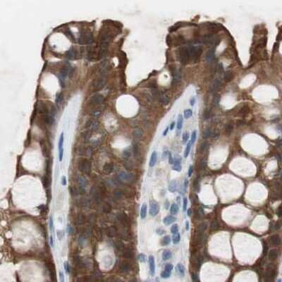 Immunohistochemistry-Paraffin: Villin 1 Antibody [NBP1-85336]