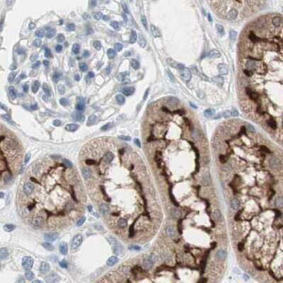Immunohistochemistry-Paraffin: Villin 1 Antibody [NBP1-85336]