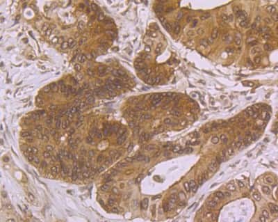 Immunohistochemistry-Paraffin: Villin 1 Antibody (JU34-75) [NBP2-75707]