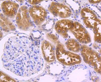 Immunohistochemistry-Paraffin: Villin 1 Antibody (JU34-75) [NBP2-75707]