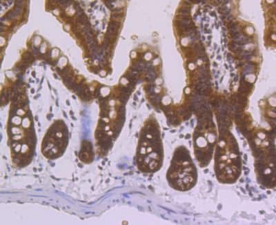 Immunohistochemistry-Paraffin: Villin 1 Antibody (JU34-75) [NBP2-75707]