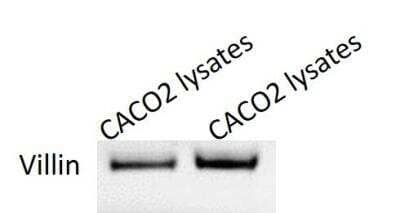 Western Blot: Villin 1 Antibody (JU34-75) [NBP2-75707]