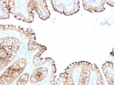 Immunohistochemistry-Paraffin: Villin 1 Antibody (VIL1/1314 + VIL1/2376) - Azide and BSA Free [NBP3-08919]
