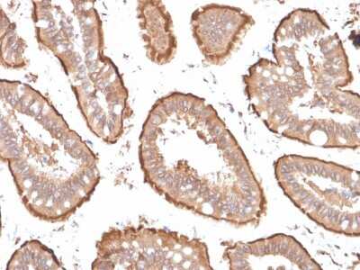 Immunohistochemistry-Paraffin: Villin 1 Antibody (VIL1/1314 + VIL1/2376) [NBP3-07176]