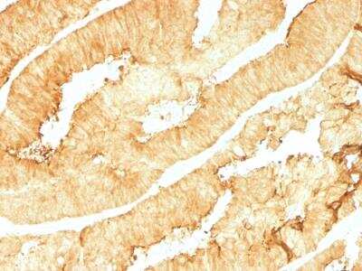 Immunohistochemistry-Paraffin: Villin 1 Antibody (VIL1/1314) - Azide and BSA Free [NBP2-50081]