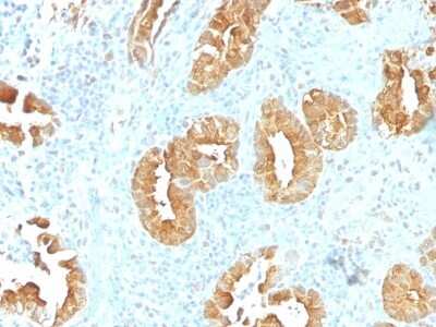 Immunohistochemistry-Paraffin: Villin 1 Antibody (VIL1/1314) [NBP2-53195]