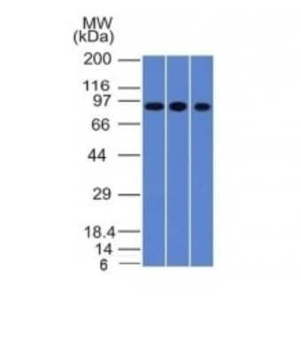 Western Blot: Villin 1 Antibody (VIL1/1314) [NBP2-53195]