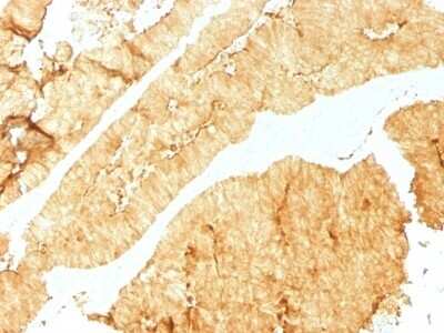 Immunohistochemistry-Paraffin: Villin 1 Antibody (VIL1/1325) [NBP2-53201]