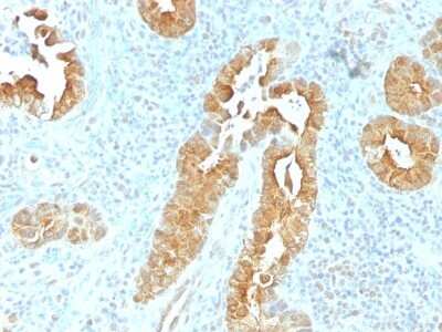 Immunohistochemistry-Paraffin: Villin 1 Antibody (VIL1/1325) [NBP2-53201]