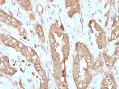 Immunohistochemistry-Paraffin: Villin 1 Antibody (VIL1/2310R) - Azide and BSA Free [NBP3-08929]