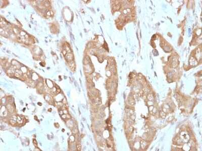 Immunohistochemistry-Paraffin: Villin 1 Antibody (VIL1/2310R) [NBP3-07184]