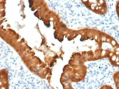 Immunohistochemistry-Paraffin: Villin 1 Antibody (VIL1/2376) - Azide and BSA Free [NBP3-08928]