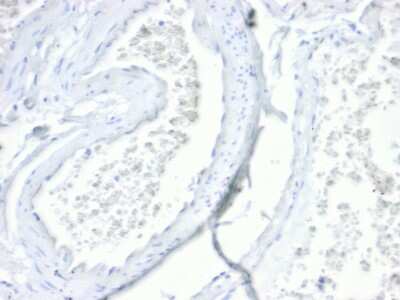 Immunohistochemistry-Paraffin: Villin 1 Antibody (VIL1/4107R) - Azide and BSA Free [NBP3-08935]