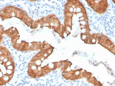 Immunohistochemistry-Paraffin: Villin 1 Antibody (VIL1/4107R) [NBP3-07190]