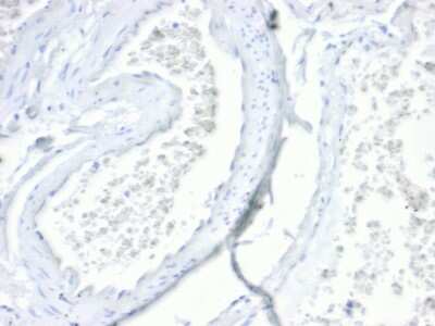 Immunohistochemistry-Paraffin: Villin 1 Antibody (VIL1/4107R) [NBP3-07190]