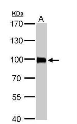 Western Blot: Villin 1 Antibody [NBP1-32841]