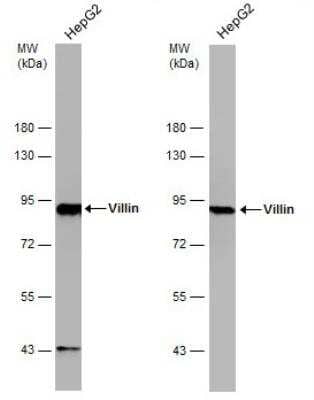 Western Blot: Villin 1 Antibody [NBP1-32841]