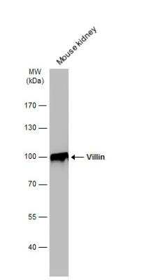 Western Blot: Villin 1 Antibody [NBP1-32841]