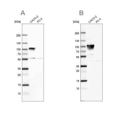 Western Blot: Villin 1 Antibody [NBP1-85335]