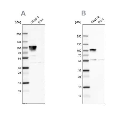 Western Blot: Villin 1 Antibody [NBP1-85336]