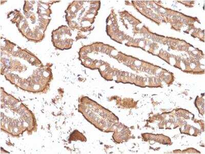 Immunohistochemistry-Paraffin: Villin 1 Antibody (rVIL1/1325) - Azide and BSA Free [NBP2-79943]
