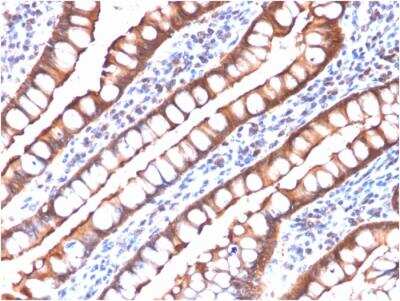 Immunohistochemistry-Paraffin: Villin 1 Antibody (rVIL1/1325) - Azide and BSA Free [NBP2-79943]