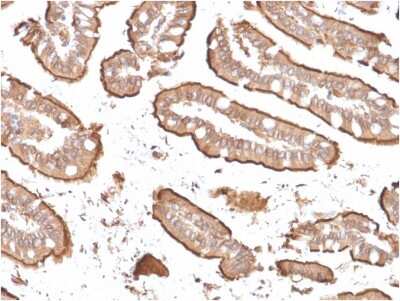 Immunohistochemistry-Paraffin: Villin 1 Antibody (rVIL1/1325) [NBP2-79809]