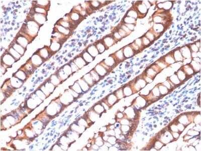 Immunohistochemistry-Paraffin: Villin 1 Antibody (rVIL1/1325) [NBP2-79809]