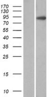 Western Blot: Villin 1 Overexpression Lysate [NBP2-10381]