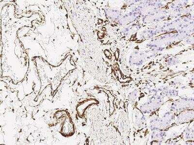Immunohistochemistry-Paraffin: Vimentin Antibody (001) [NBP2-89210]