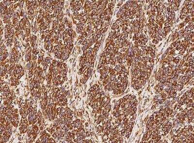 Immunohistochemistry-Paraffin: Vimentin Antibody (001) [NBP2-89210]