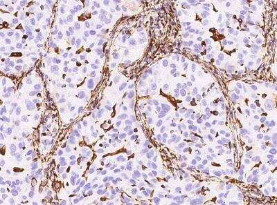Immunohistochemistry-Paraffin: Vimentin Antibody (001) [NBP2-89210]