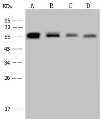 Western Blot: Vimentin Antibody (001) [NBP2-89210]