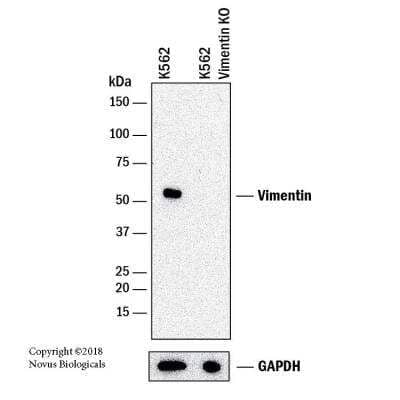 Knockout Validated: Vimentin Antibody (2A52) [NBP1-92688]