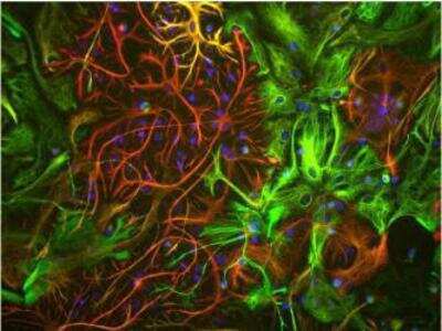 Immunocytochemistry/ Immunofluorescence: Vimentin Antibody (2D1) [NBP1-92687]