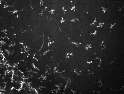 Immunohistochemistry: Vimentin Antibody (2D1) [NBP1-92687]