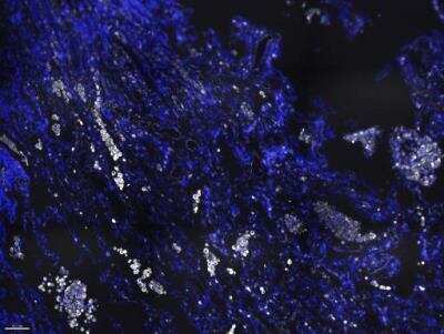 Immunohistochemistry-Paraffin: Vimentin Antibody (2D1) [NBP1-92687]