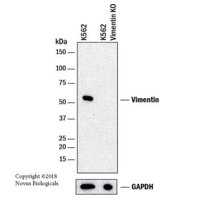 Knockout Validated: Vimentin Antibody (2D1) [NBP1-92687]