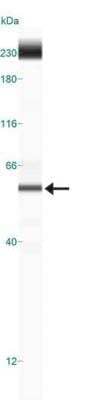 Simple Western: Vimentin Antibody (2D1) [NBP1-92687]