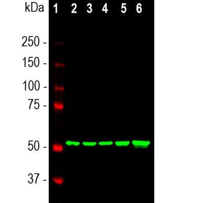 Western Blot: Vimentin Antibody (2D1) [NBP1-92687]