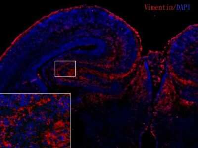 Immunohistochemistry-Frozen: Vimentin Antibody (812) [NBP2-43560]