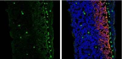 Immunohistochemistry-Frozen: Vimentin Antibody (812) [NBP2-43560]