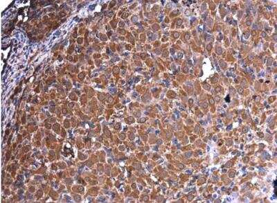 Immunohistochemistry-Paraffin: Vimentin Antibody (812) [NBP2-43560]