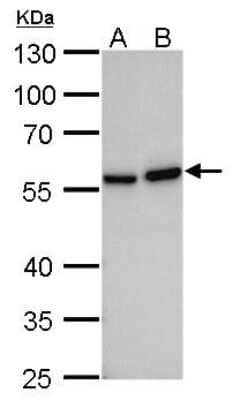 Western Blot: Vimentin Antibody (812) [NBP2-43560]