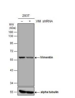 Knockdown Validated: Vimentin Antibody (812) [NBP2-43560]