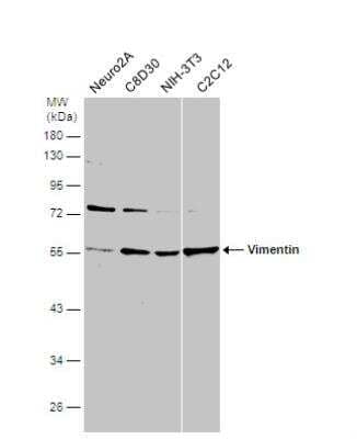 Western Blot: Vimentin Antibody (812) [NBP2-43560]
