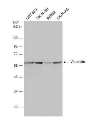 Western Blot: Vimentin Antibody (812) [NBP2-43560]