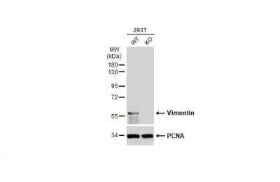 Knockout Validated: Vimentin Antibody (812) [NBP2-43560]